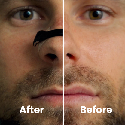 Breathon™ Nasal Airflow Band